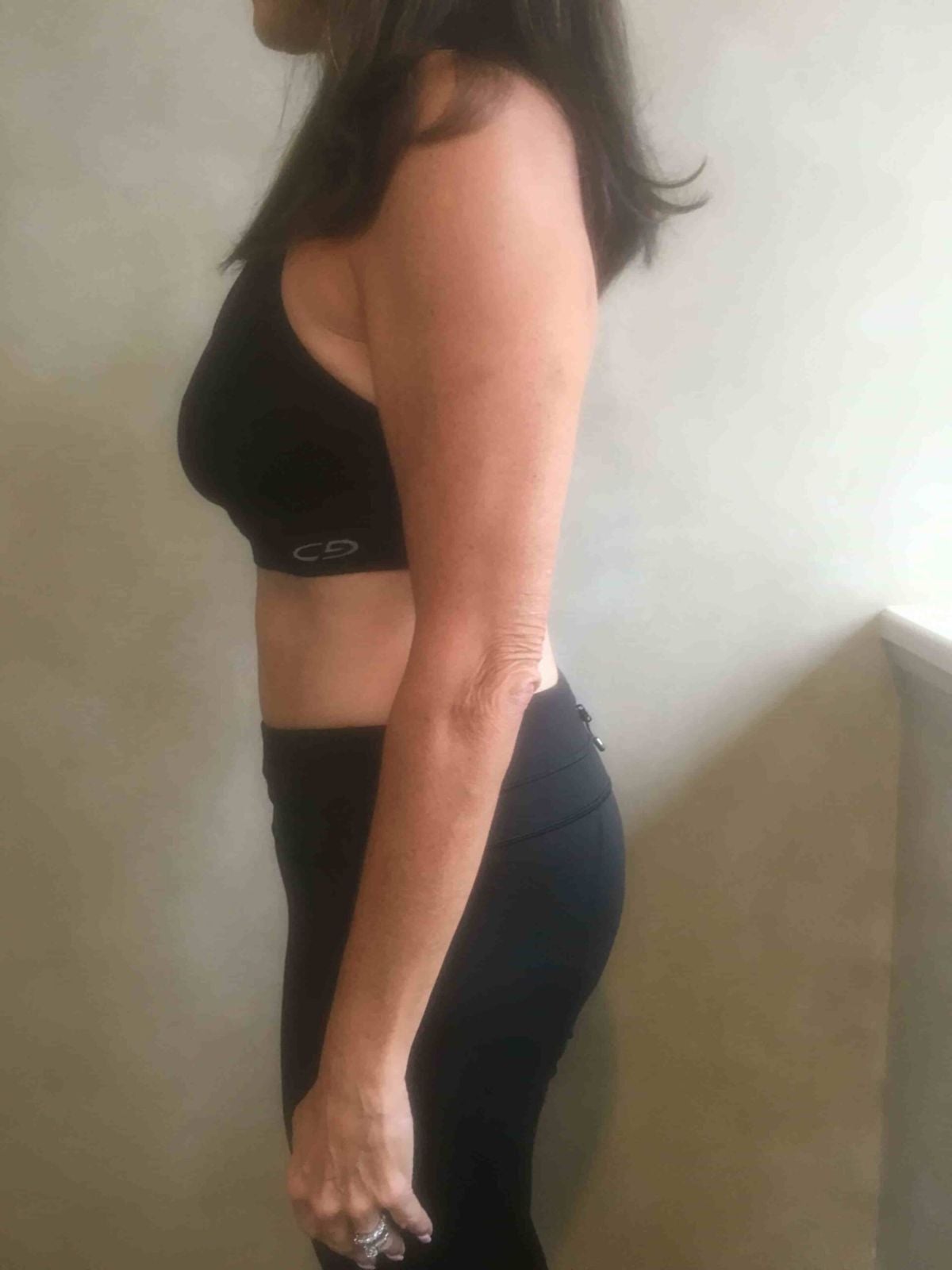 Happy Woman Showing Her Slim Figure After Successful Weight Loss Program, Pikesville, MD
